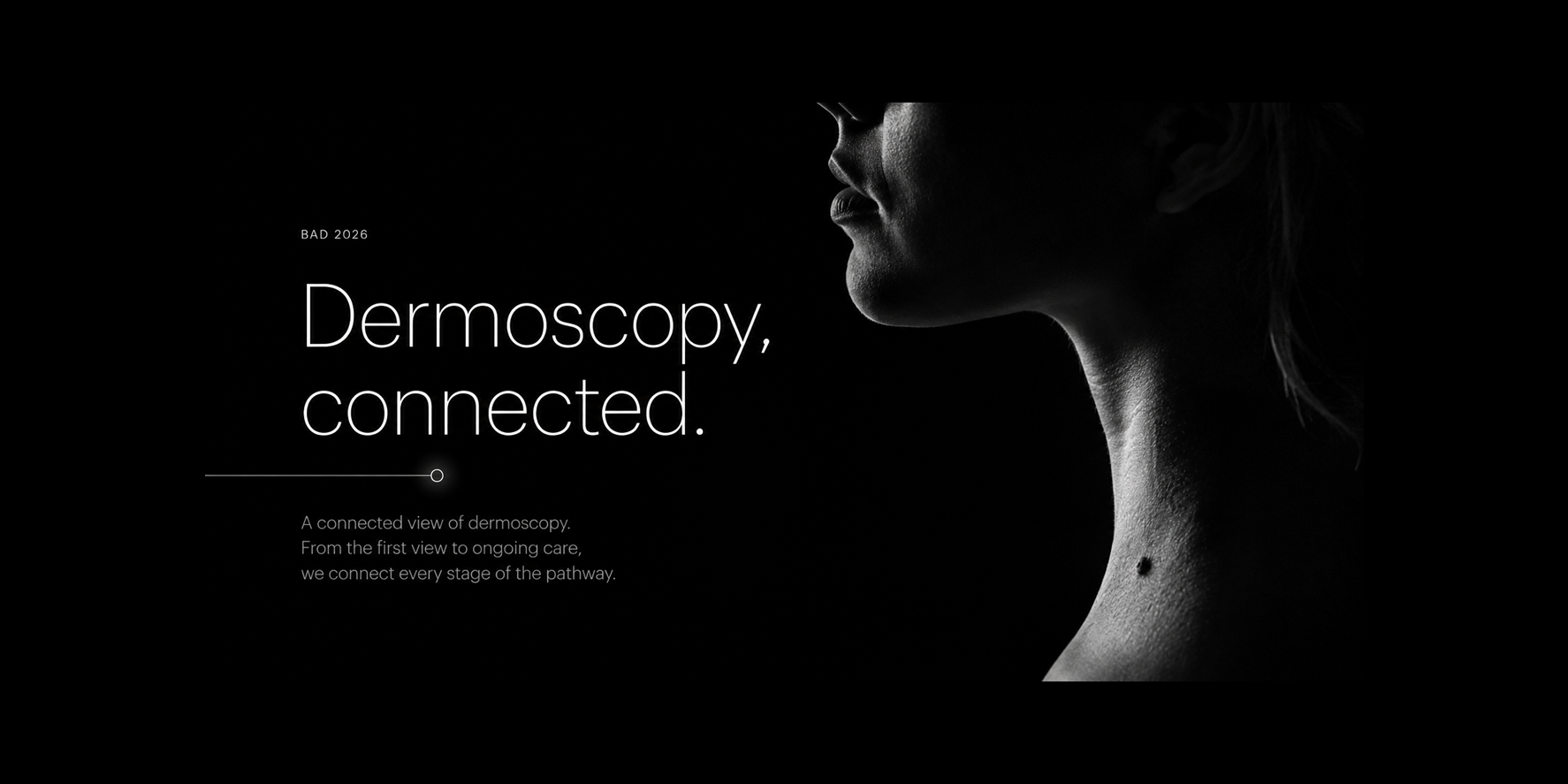 Women model cropped with mole one neck
