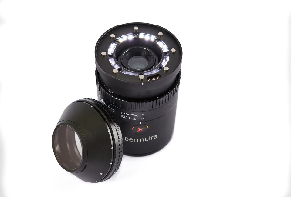 DermLite Foto II Pro dermatoscope with removable cap.