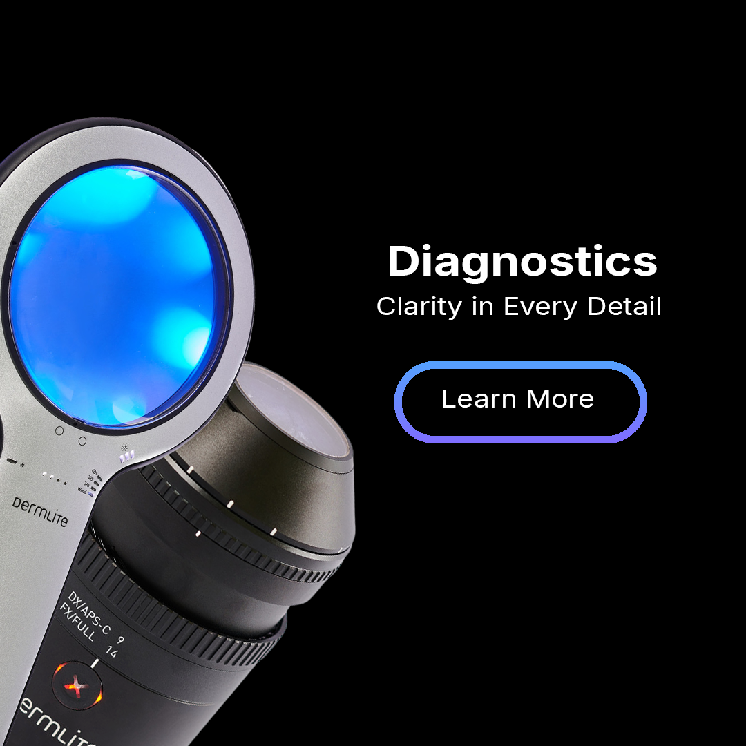 Lumio 2 and DermLite Foto II Pro