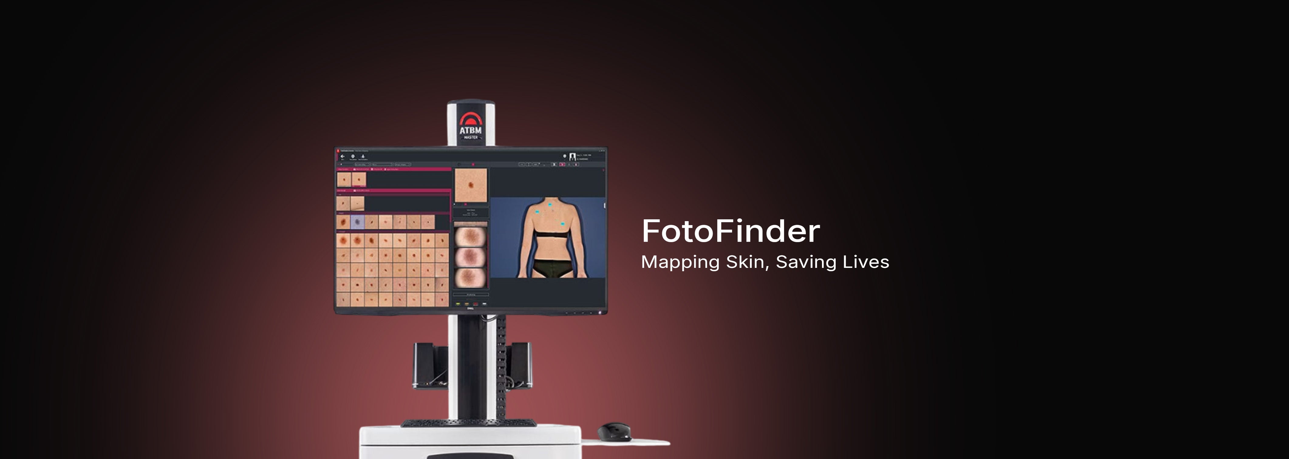 FotoFInder Mapping Skin, Saving Lives
