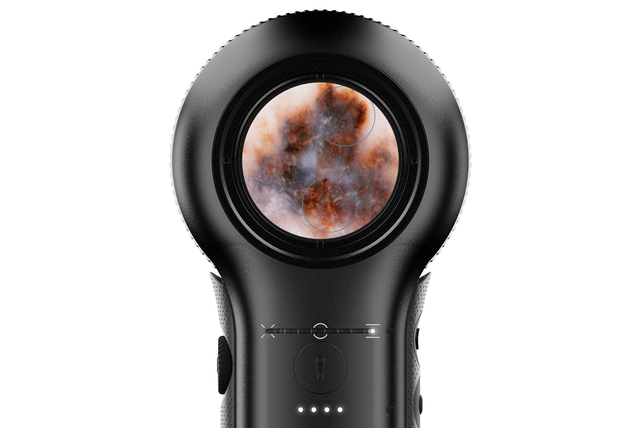 DermLite DL5 dermatoscope viewing lesions with PigmentBoost.