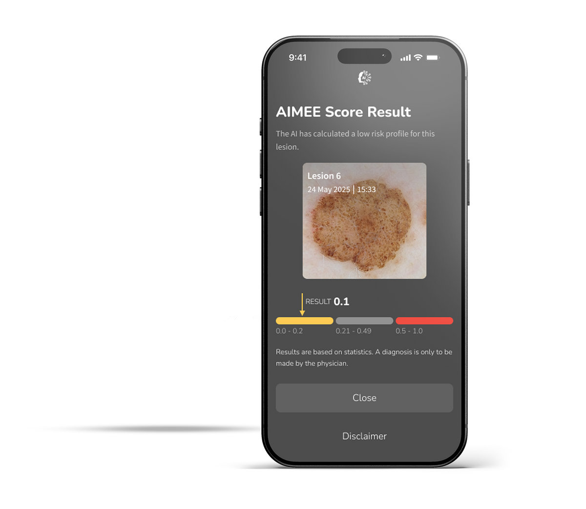 DermLite DL5 Plus scoring lesion using AIMEE AI workflow tool
