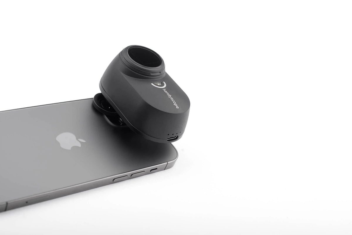 FotoFinder DermLite Handyscope on phone 4