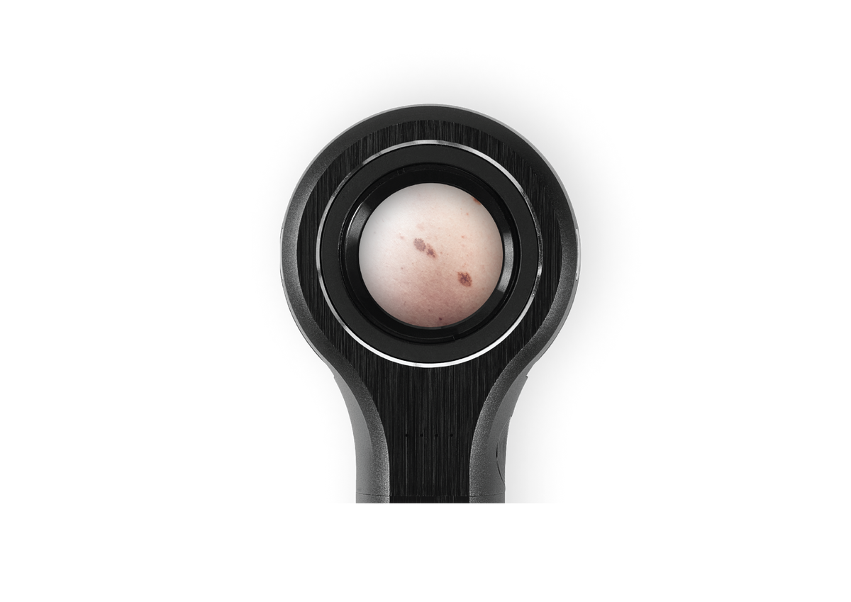 DL4 focusing on lesion