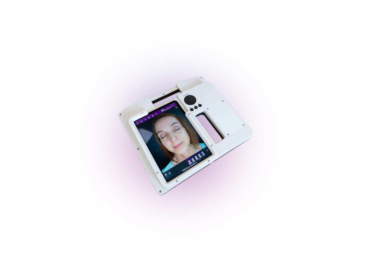 FotoFinder Meesma viewing patient history
