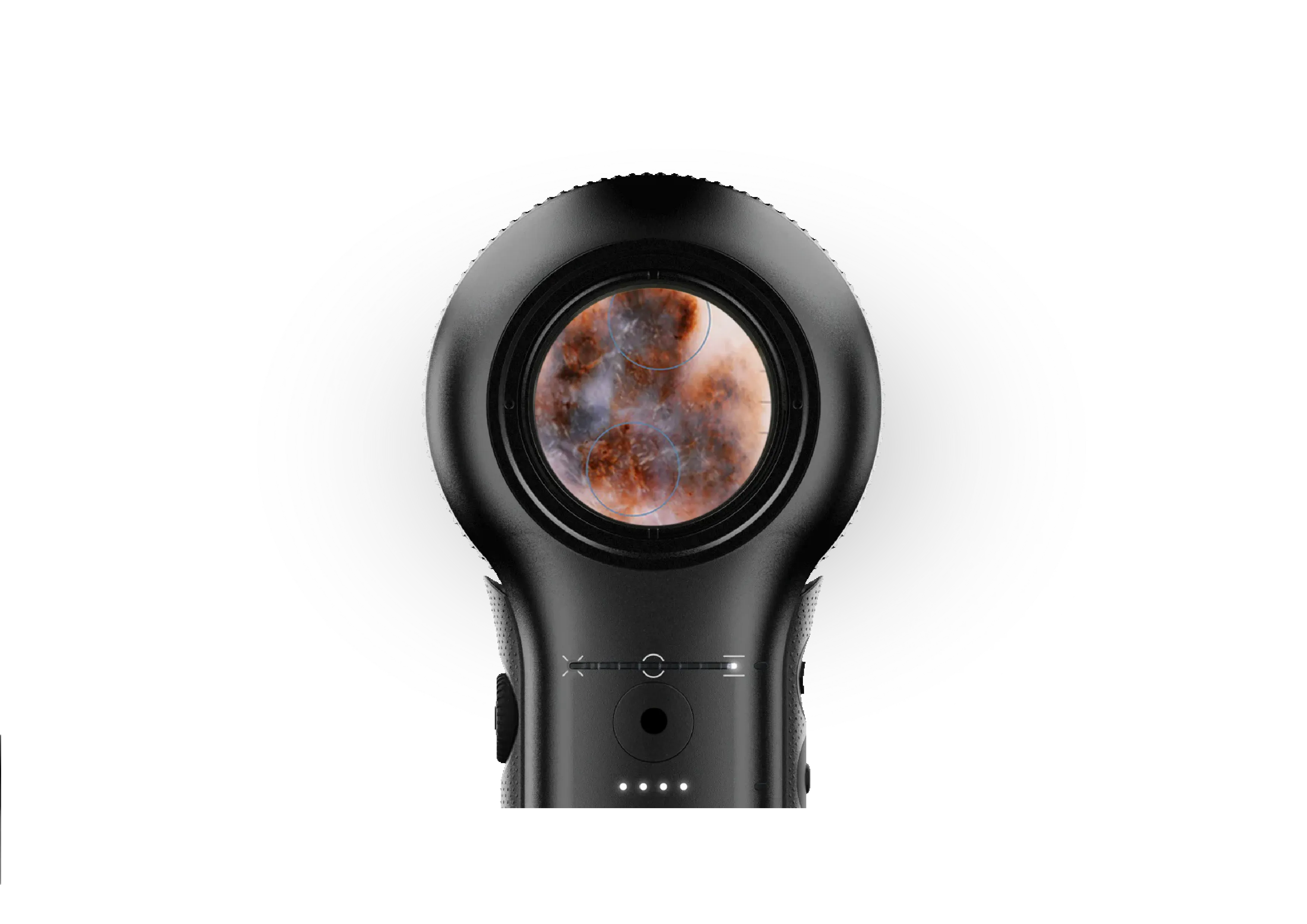 DermLite DL5 Plus viewing a lesion in pigment boost mode