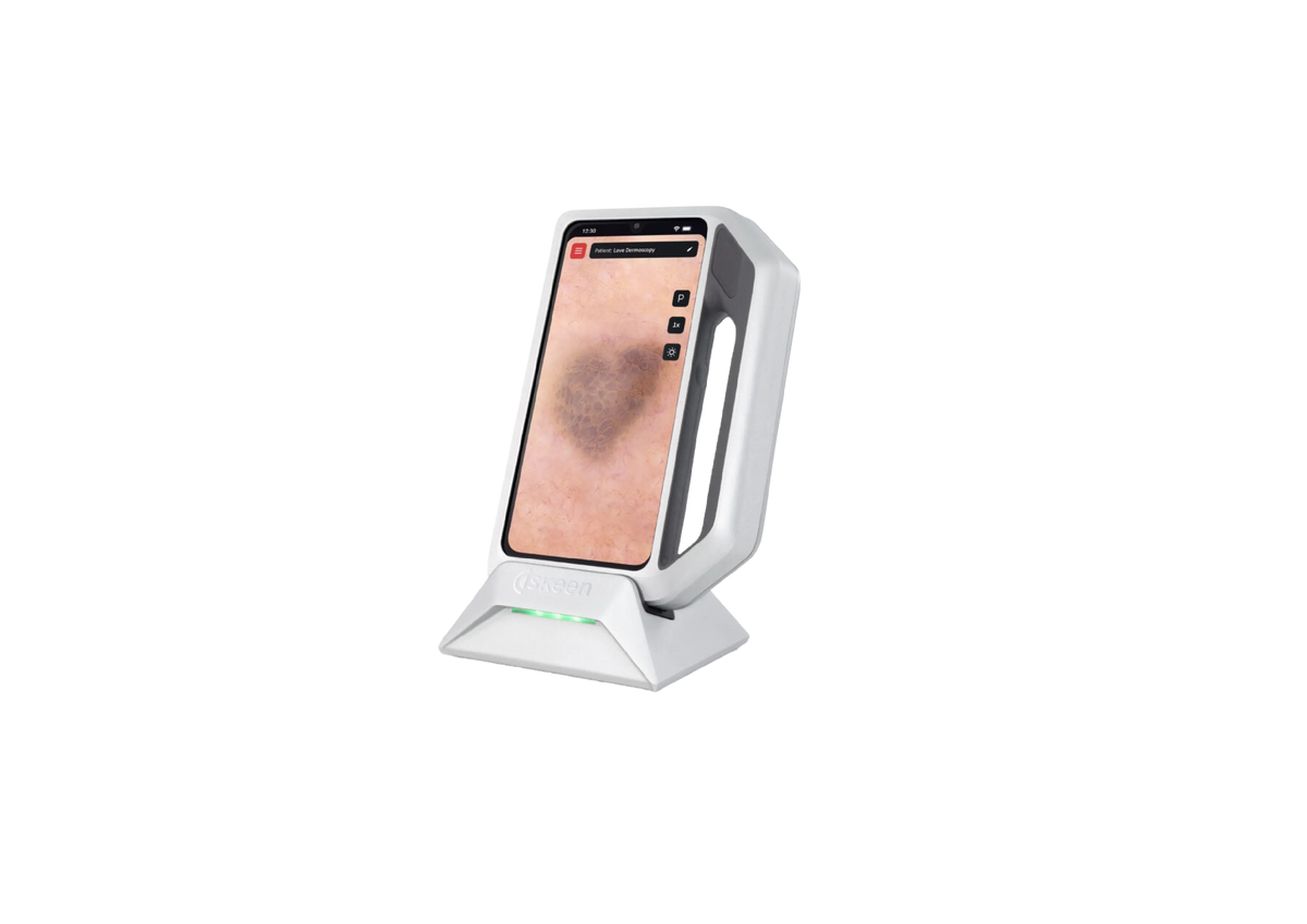 FotoFinder Skeen