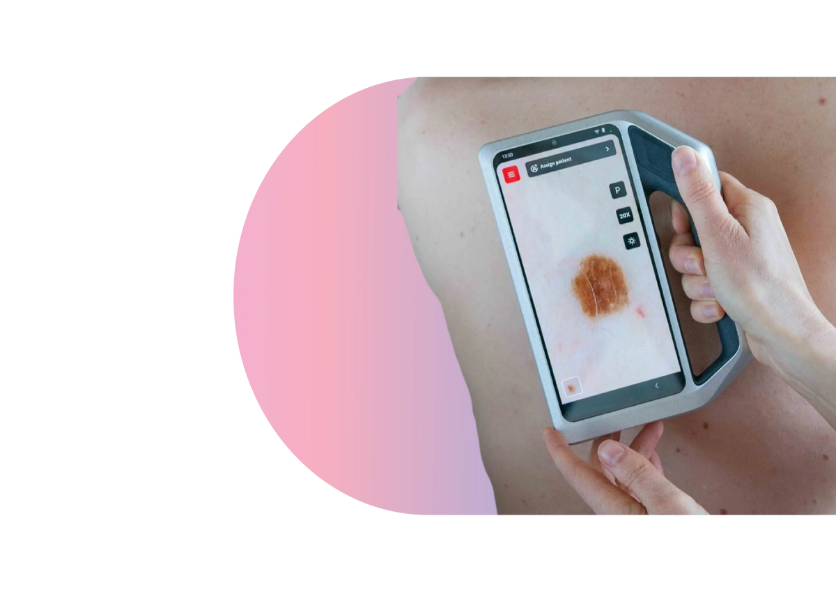 Skeen being used on a patient