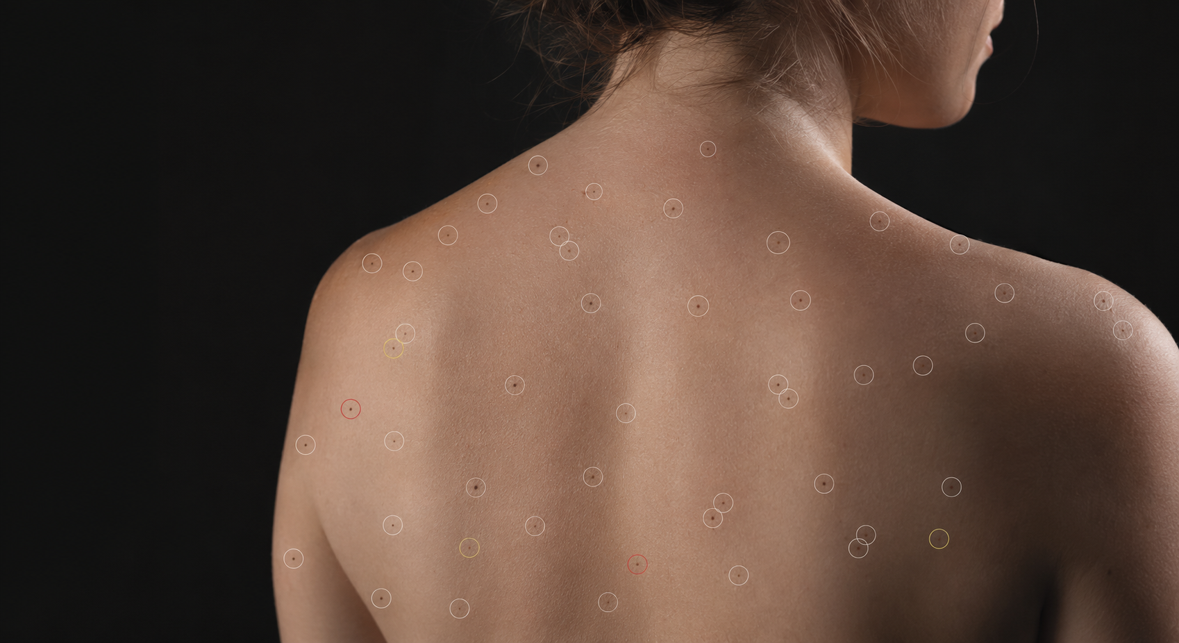 Patient lesions being scanned using the ATBM Master