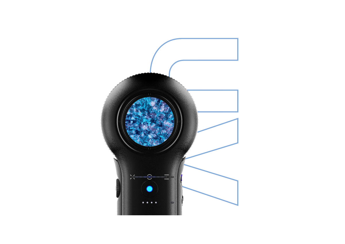 DermLite DL5 Plus viewing a lesion in UV mode