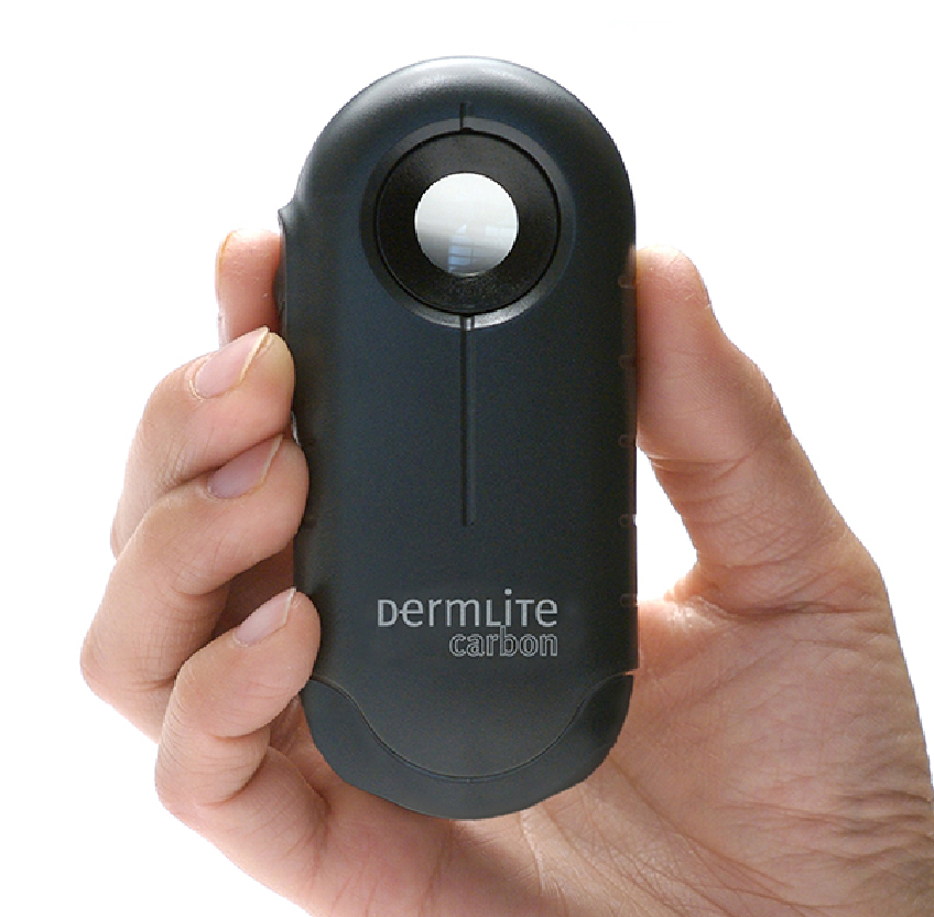DermLite Carbon with LEDs off