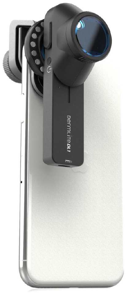 DermLite DL1 dermatoscope connected to iPhone.