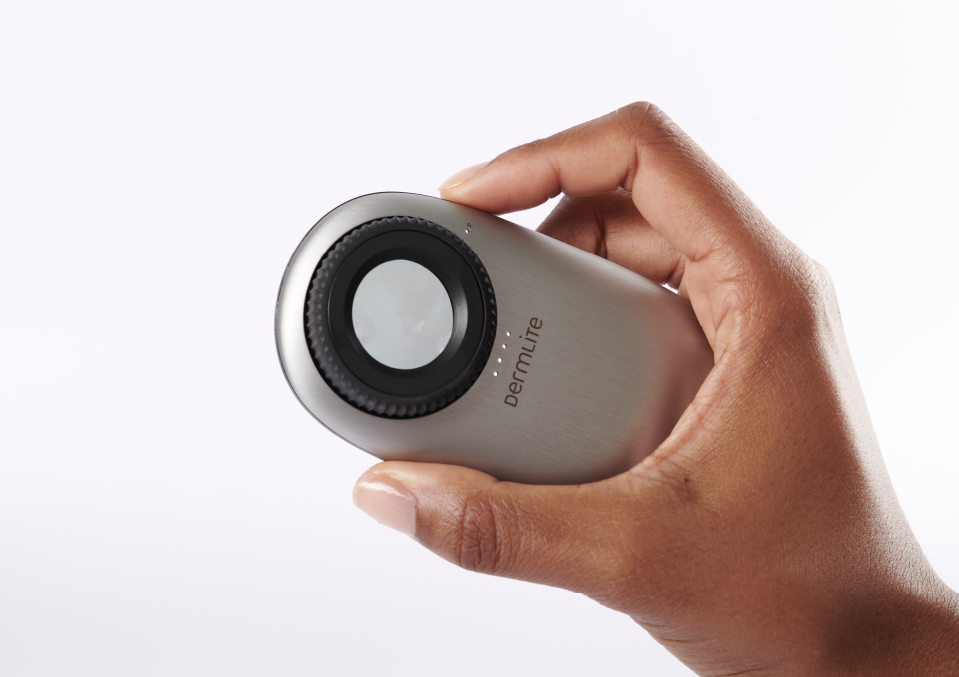 Hand holding DermLite DL200 Hybrid dermatoscope.