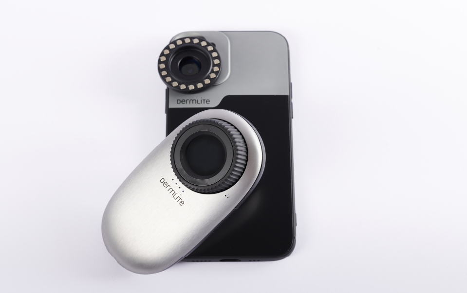 Dermlite DL200 Hybrid dermatoscope with iPhone and connection kit.