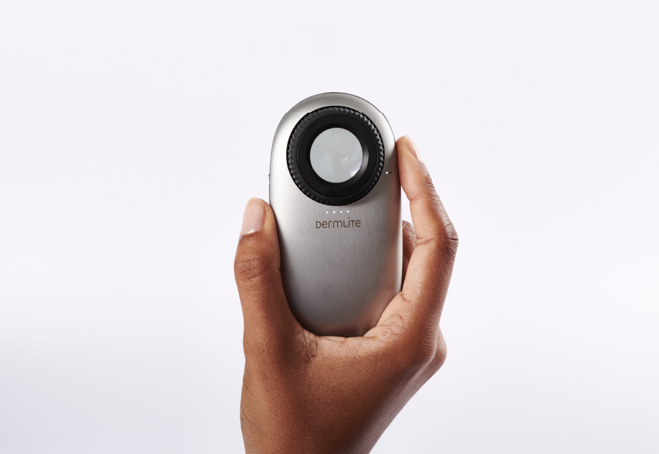Hand holding DermLite DL200 Hybrid dermatoscope device.