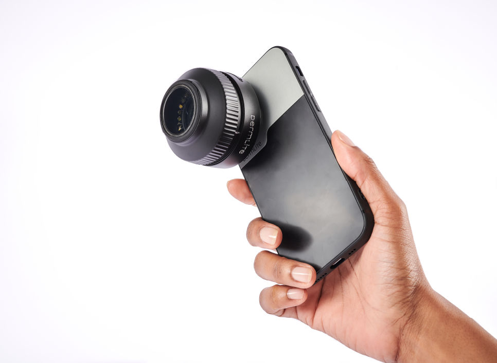 Back view of iPhone connected to DermLite Foto X dermatoscope.