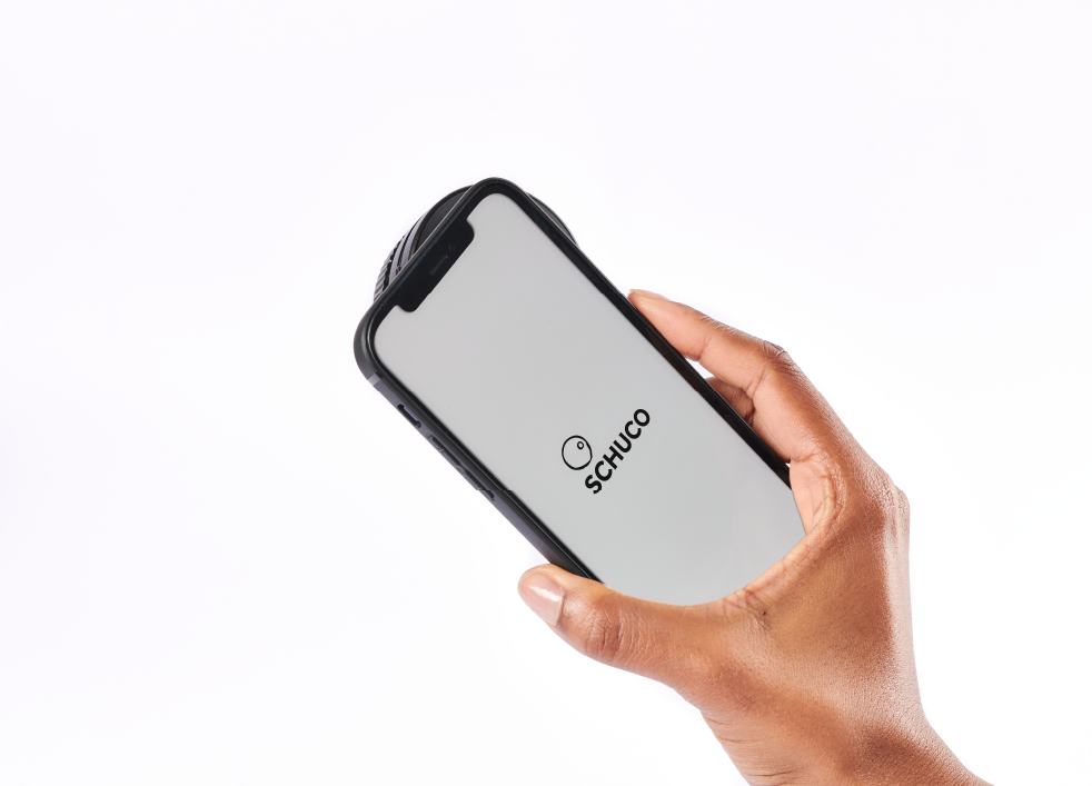 Front view of iPhone with a DermLite Foto X dermatoscope attached.