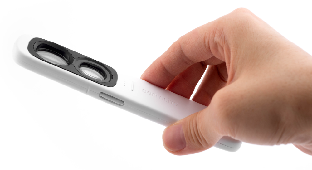 DermLite GL dermatoscope held by hand.