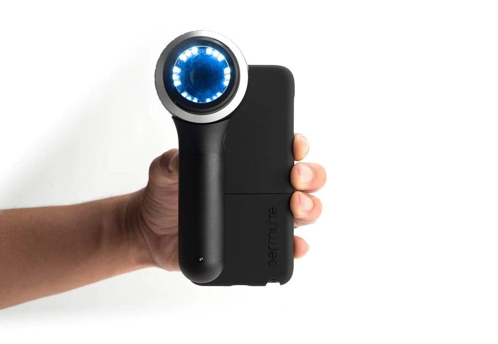 DermLite connection kit on an iPod touch and connected to a DL4 with the LEDs turned on