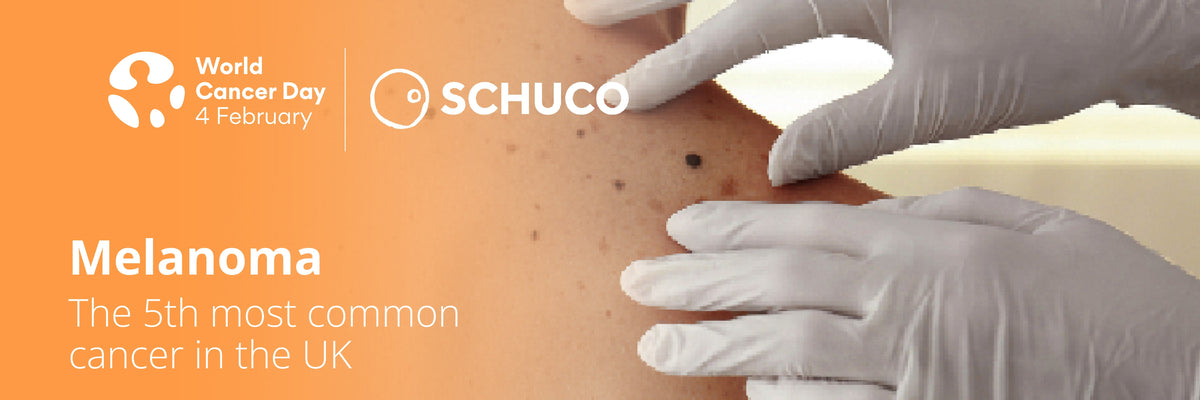 World Cancer Day: Improving Melanoma Detection with the ABCDE Rule