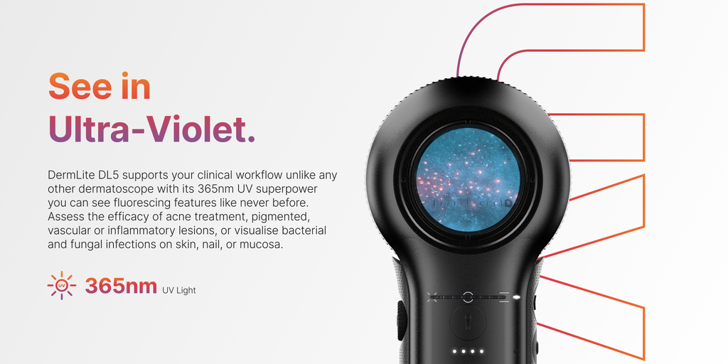 Supports clinical workflow unlike any other dermatoscope with its 365nm UV superpower you can see fluorescing features like never before. Assess the efficacy of acne treatment, pigmented, vascular or inflammatory lesions or visualise bacterial and fungal infections or skin, nail, or mucosa.