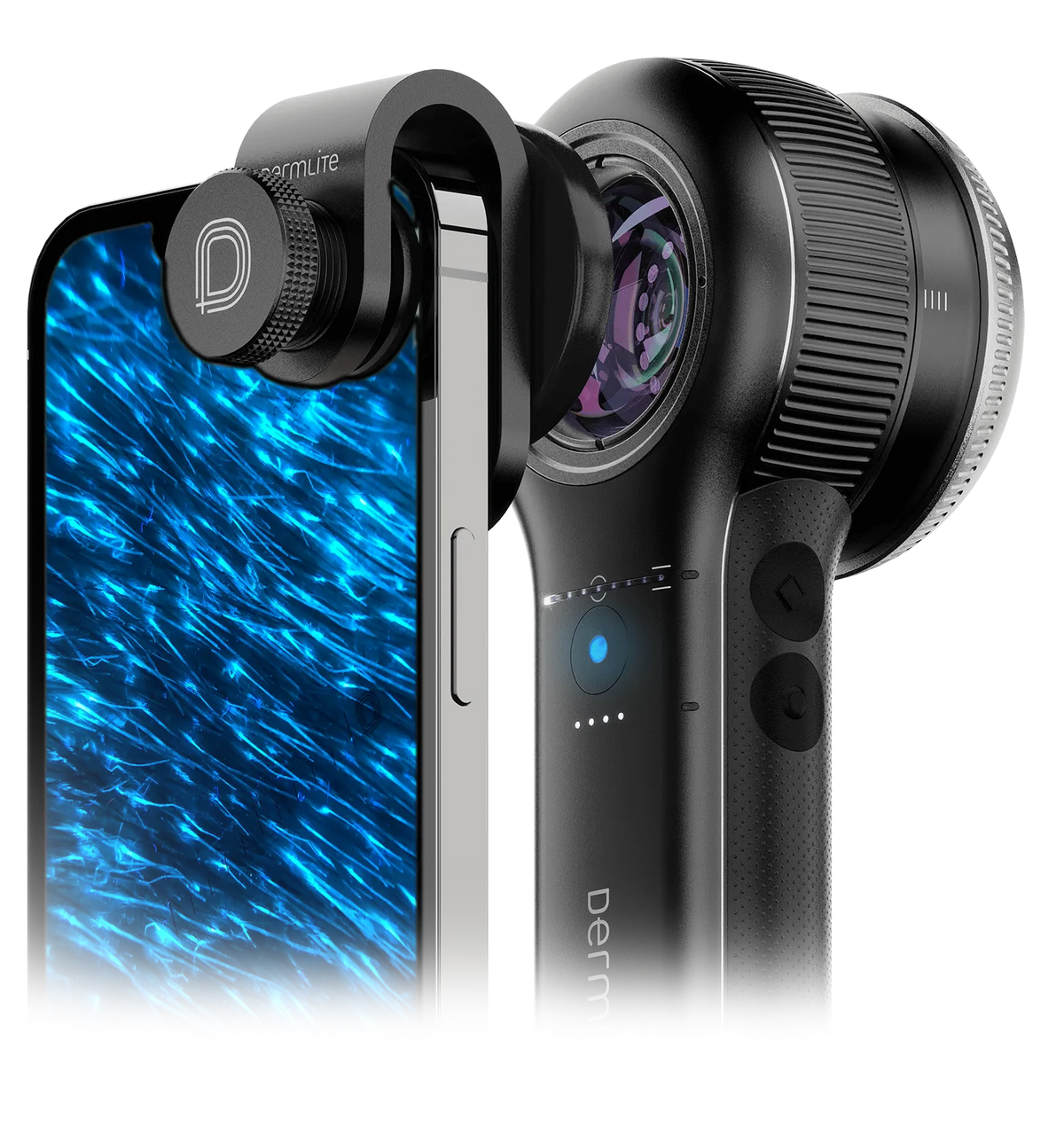 DermLite DL5 Plus connected to MCC taking image of lesion in UV mode