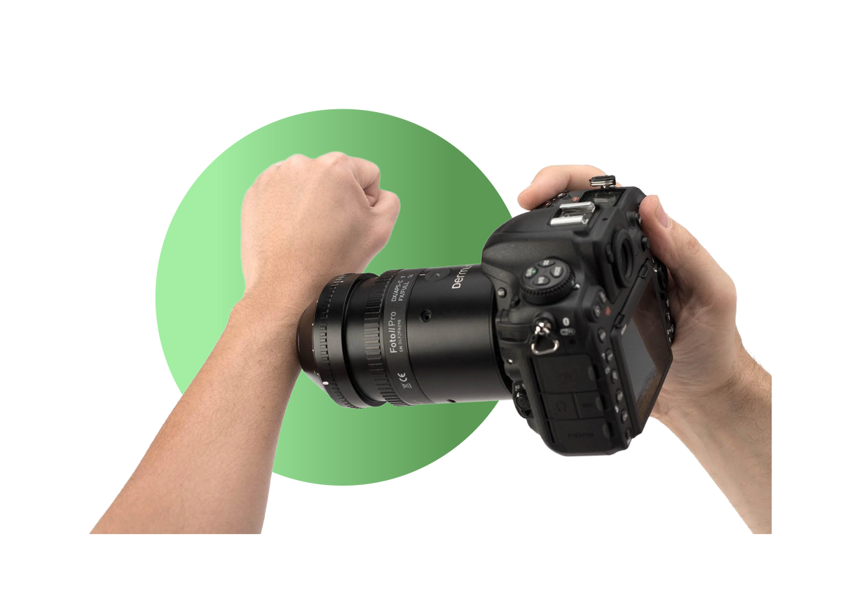Foto II Pro being used to take an image of hand