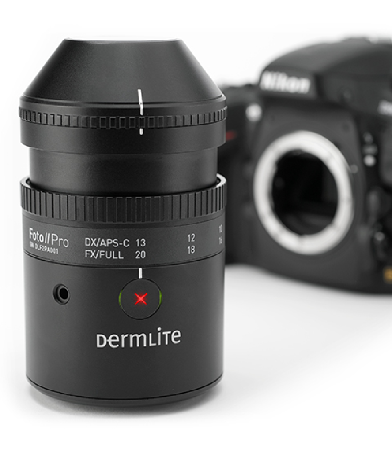 DermLite Foto II Pro dermatoscope.
