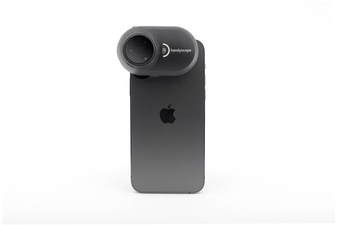 FotoFinder DermLite Handyscope on phone