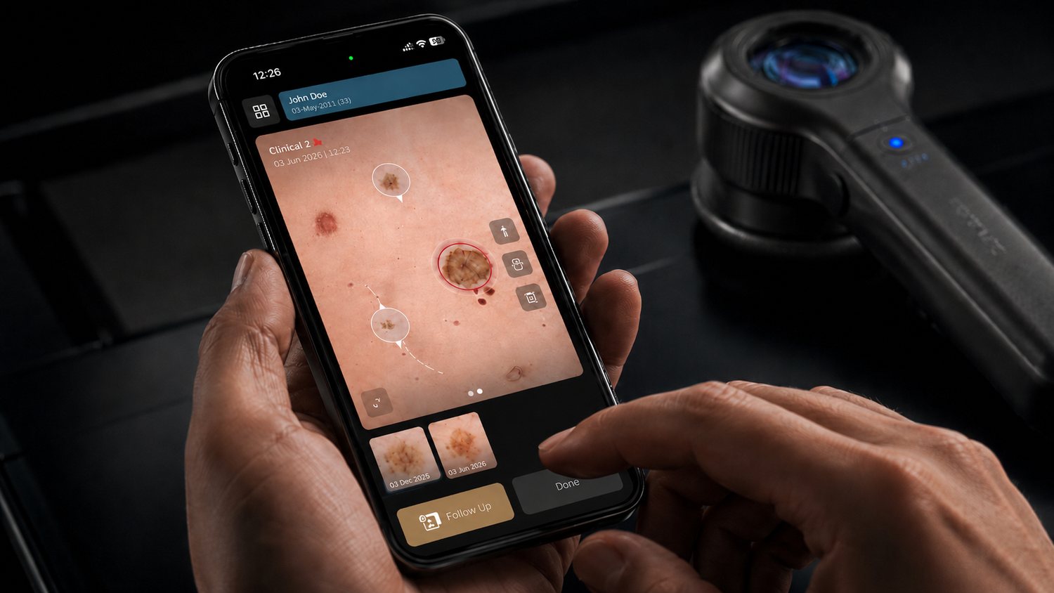 DermLite DL5+ with the DermLite App