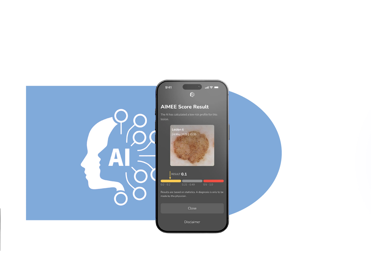 DermLite DL5 Plus using AIMEE AI workflow tool