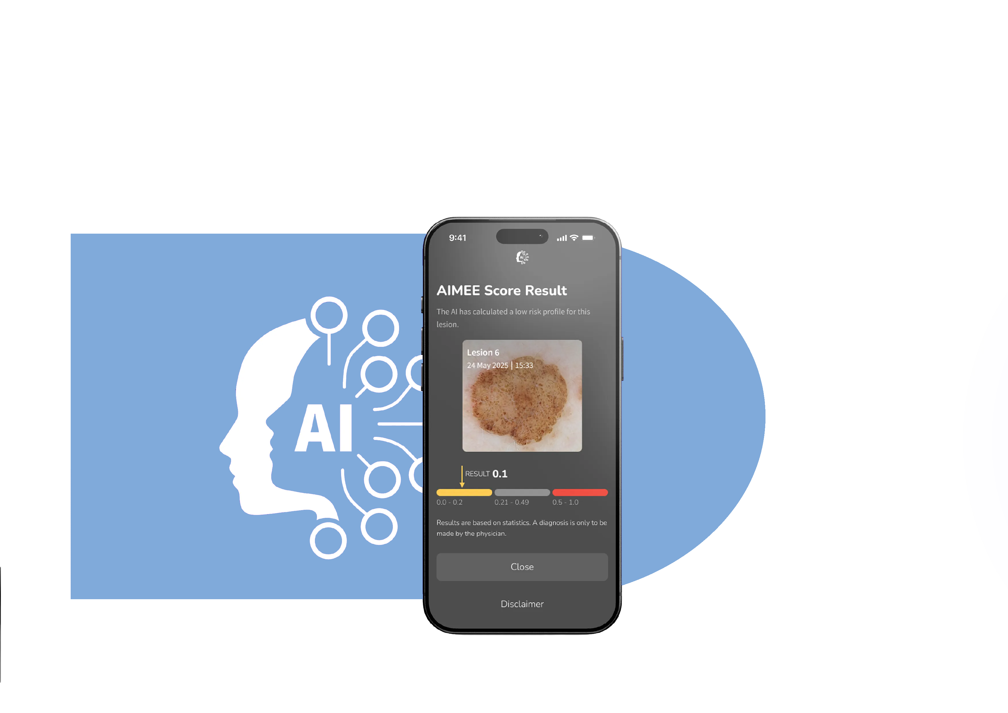 DermLite DL5 Plus using AIMEE AI workflow tool