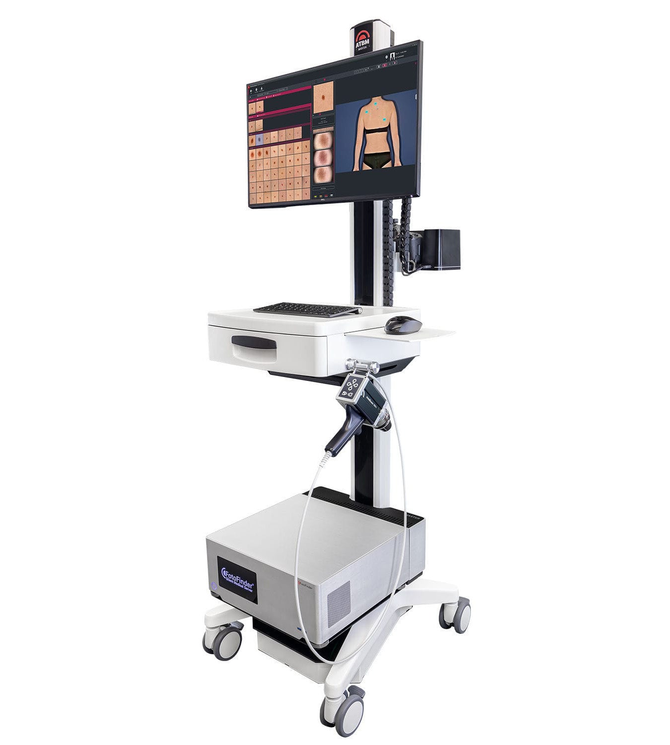 FotoFinder ATBM Master