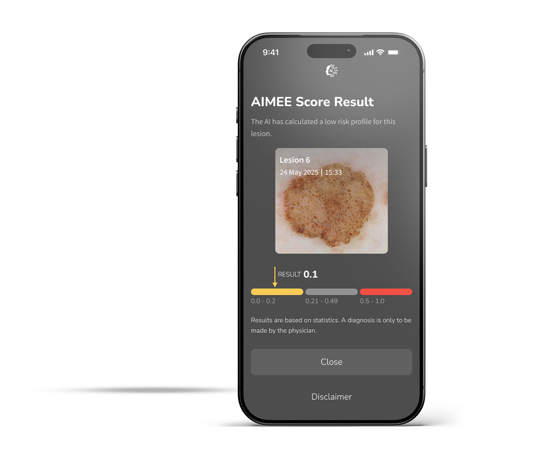 DermLite DL5 Plus scoring lesion using AIMEE AI workflow tool