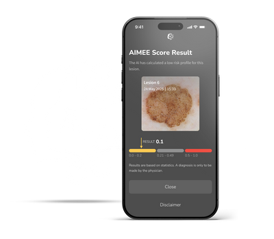 DermLite DL5 Plus scoring lesion using AIMEE AI workflow tool