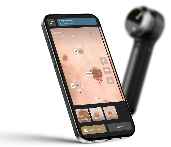 Capturing and reviewing DermLite DL5 Plus images with the DermLite app