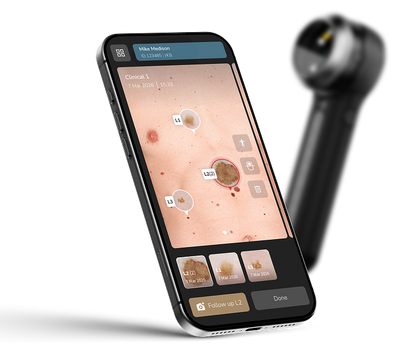 Capturing and reviewing DermLite DL5 Plus images with the DermLite app