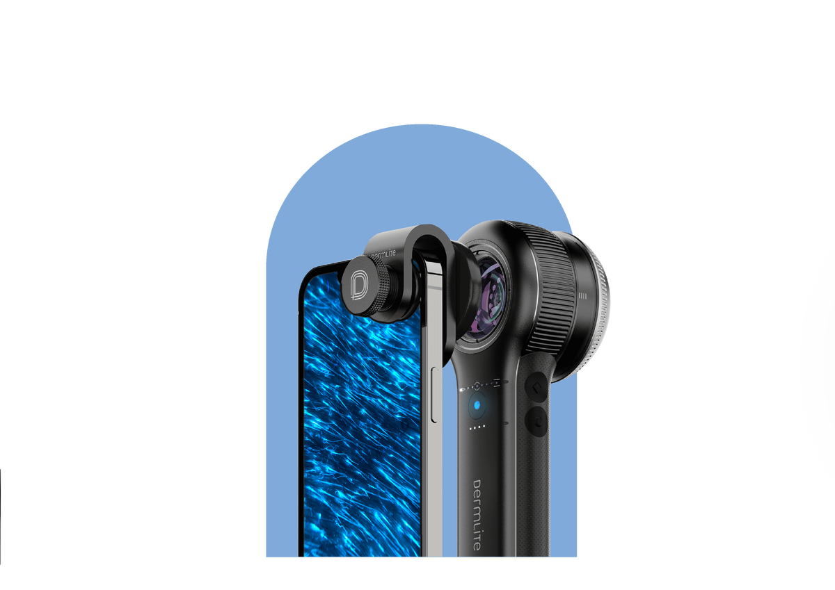 DermLite DL5 viewing a lesion connected to phone via MCC