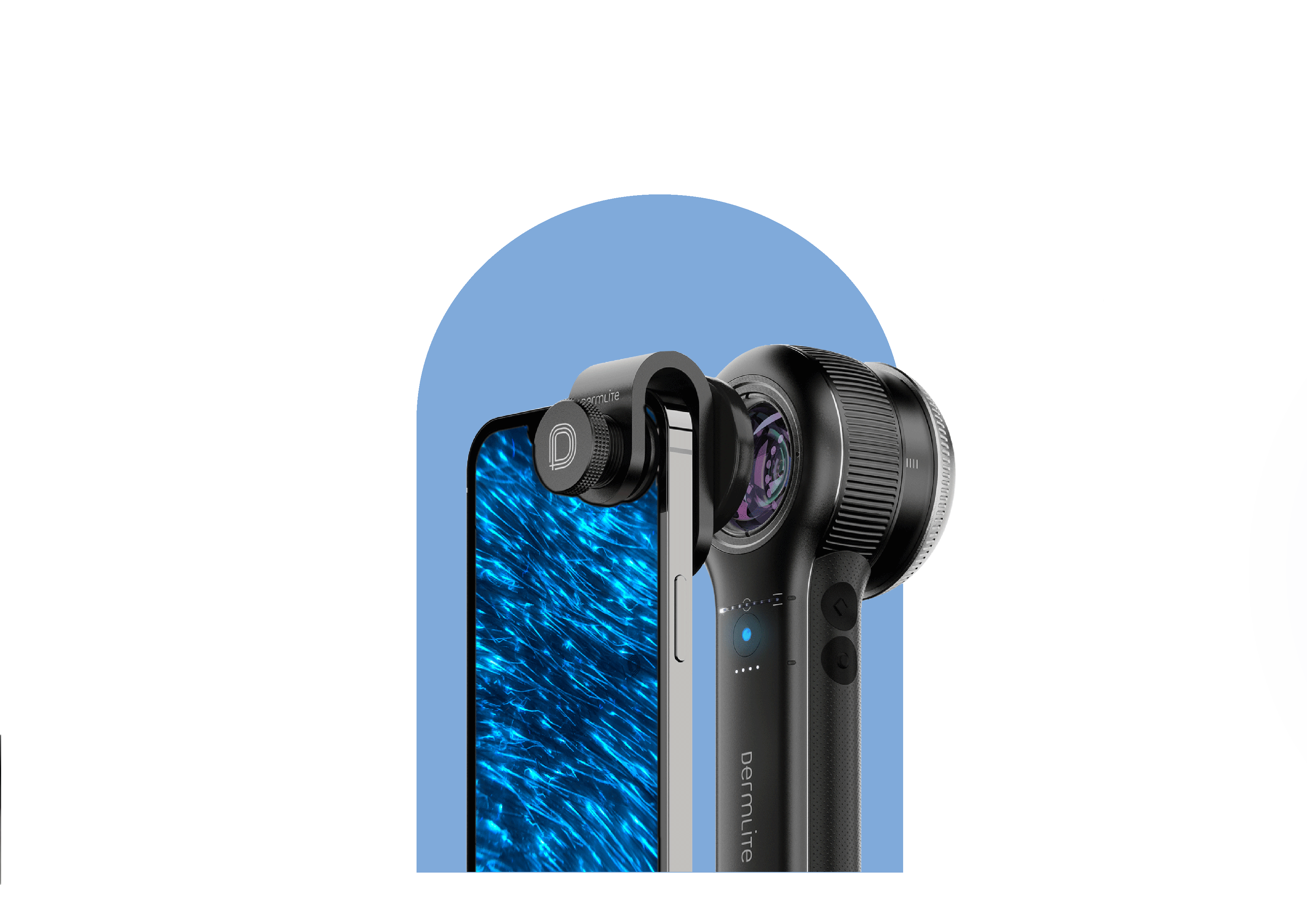 DermLite DL5 viewing a lesion connected to phone via MCC