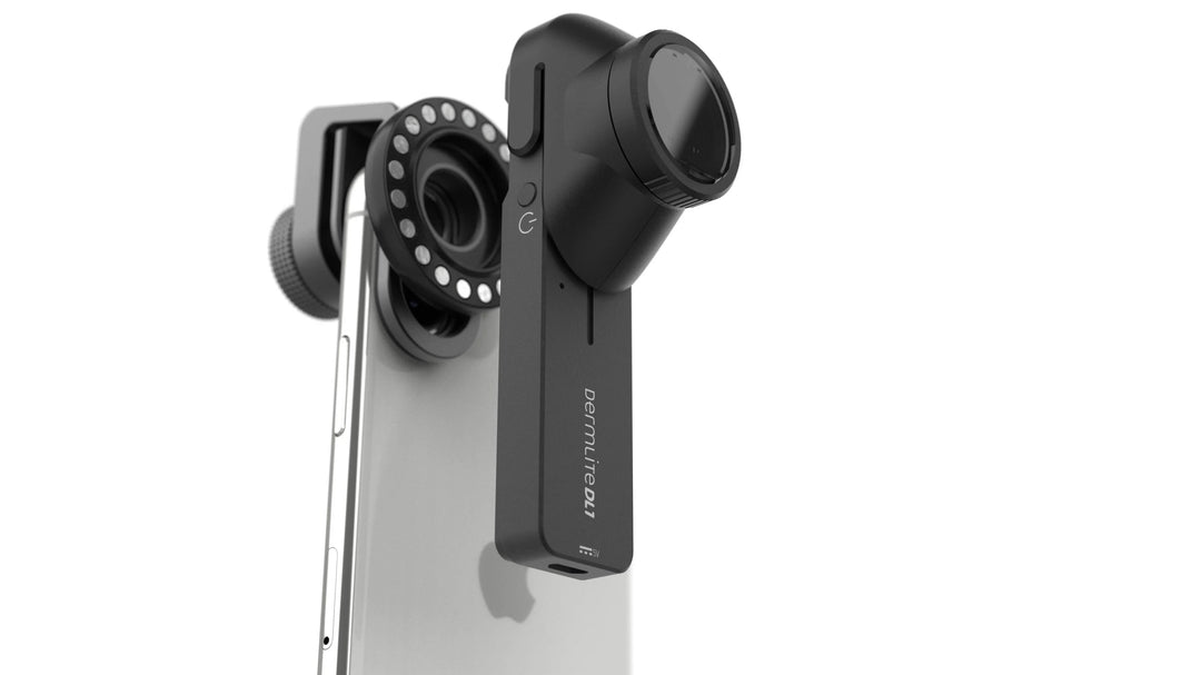Phone case with a DL1 basic attachment on a white background