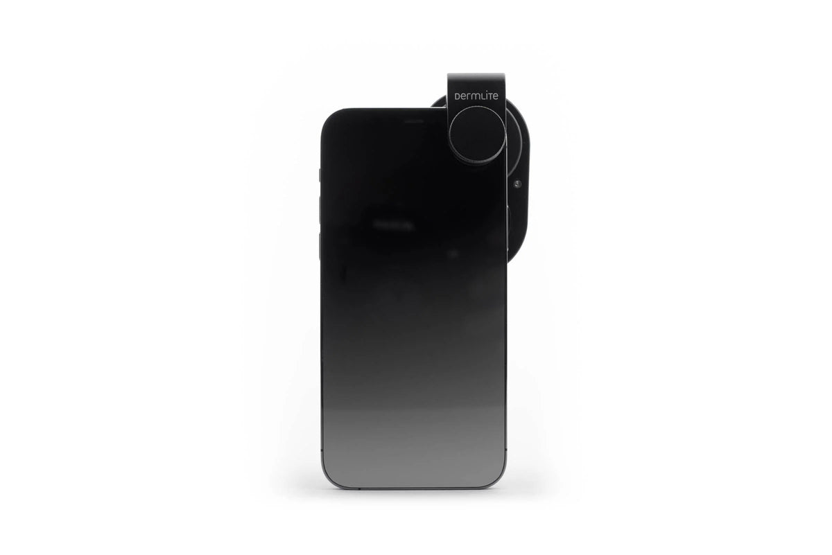 FotoFinder DermLite Handyscope on phone 2
