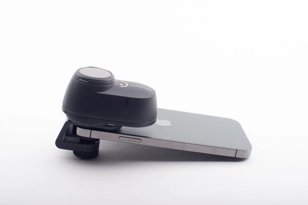 FotoFinder DermLite Handyscope on phone 3