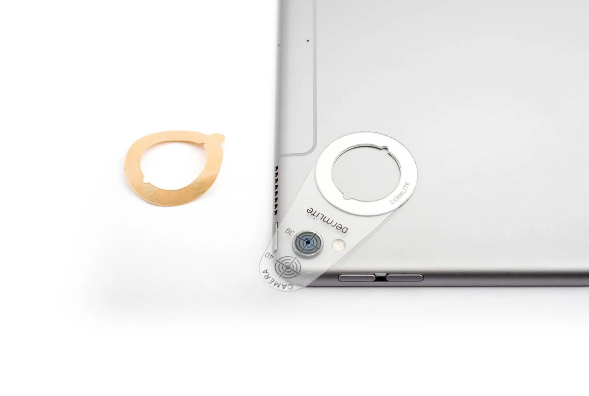 FotoFinder DermLite Handyscope with iPad