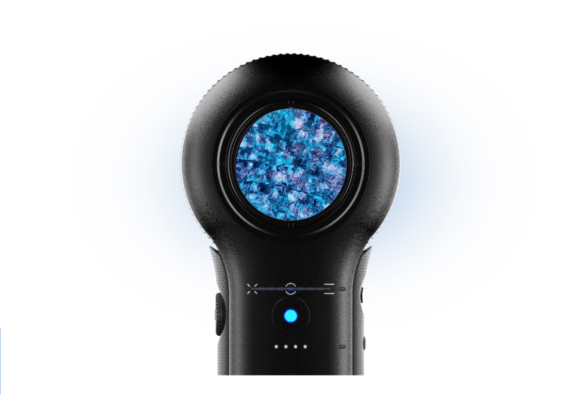 DermLite DL5 hero image
