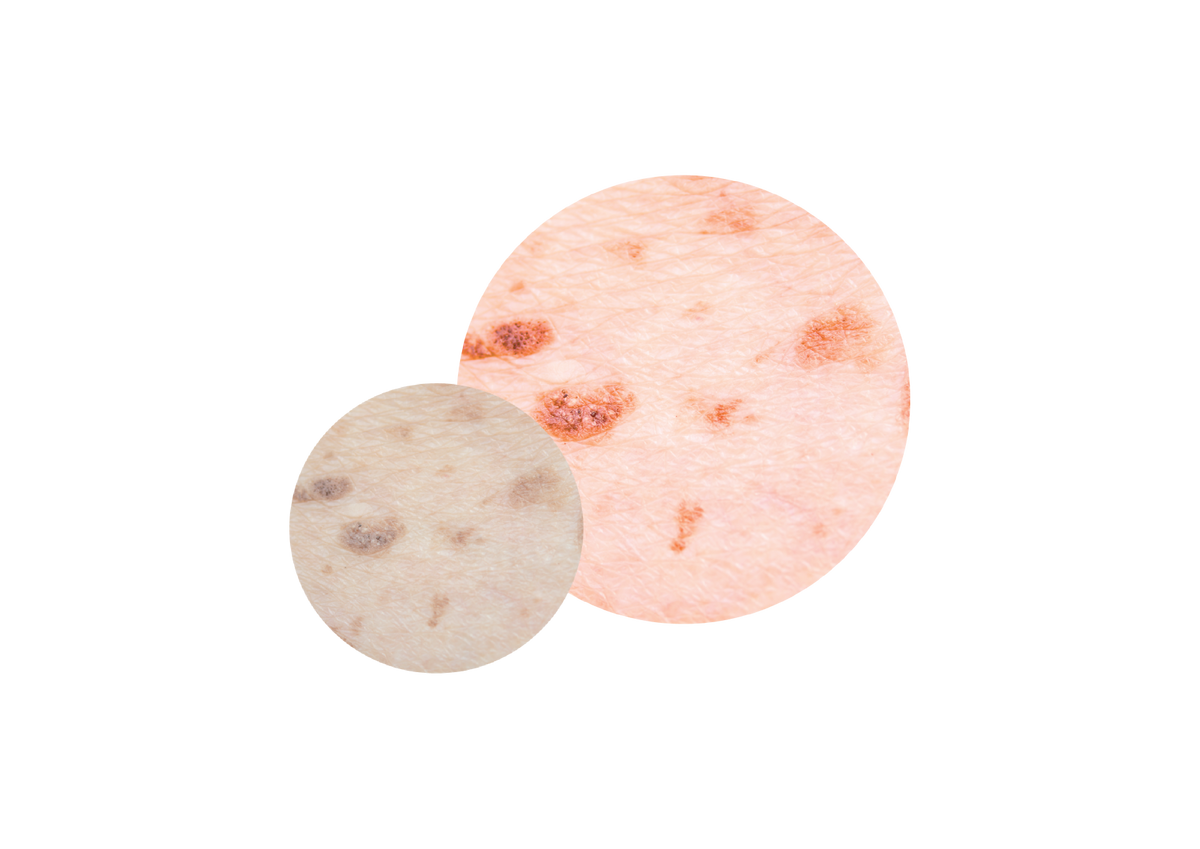 Polarised and Non-Polarised