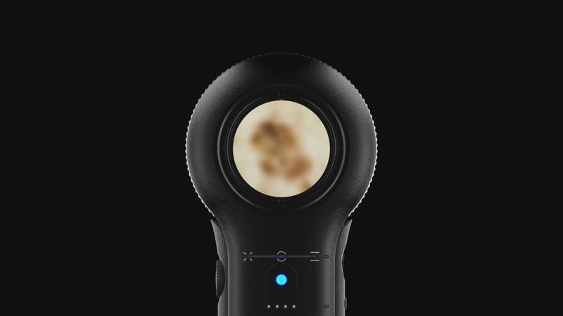 DermLite DL5 Plus Multi-Shot