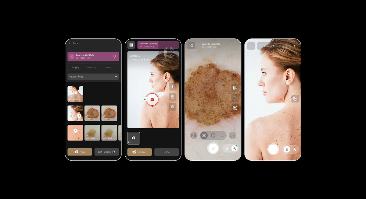 DermLite App in use capturing images