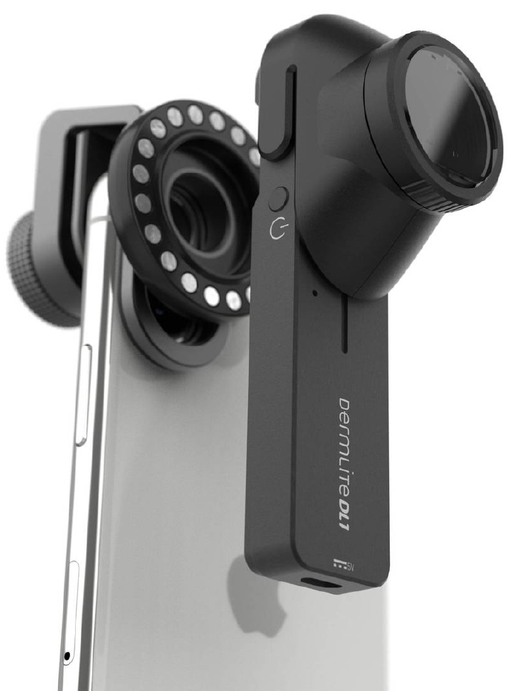 DermLite DL1 basic dermatoscope with connector and iPhone.