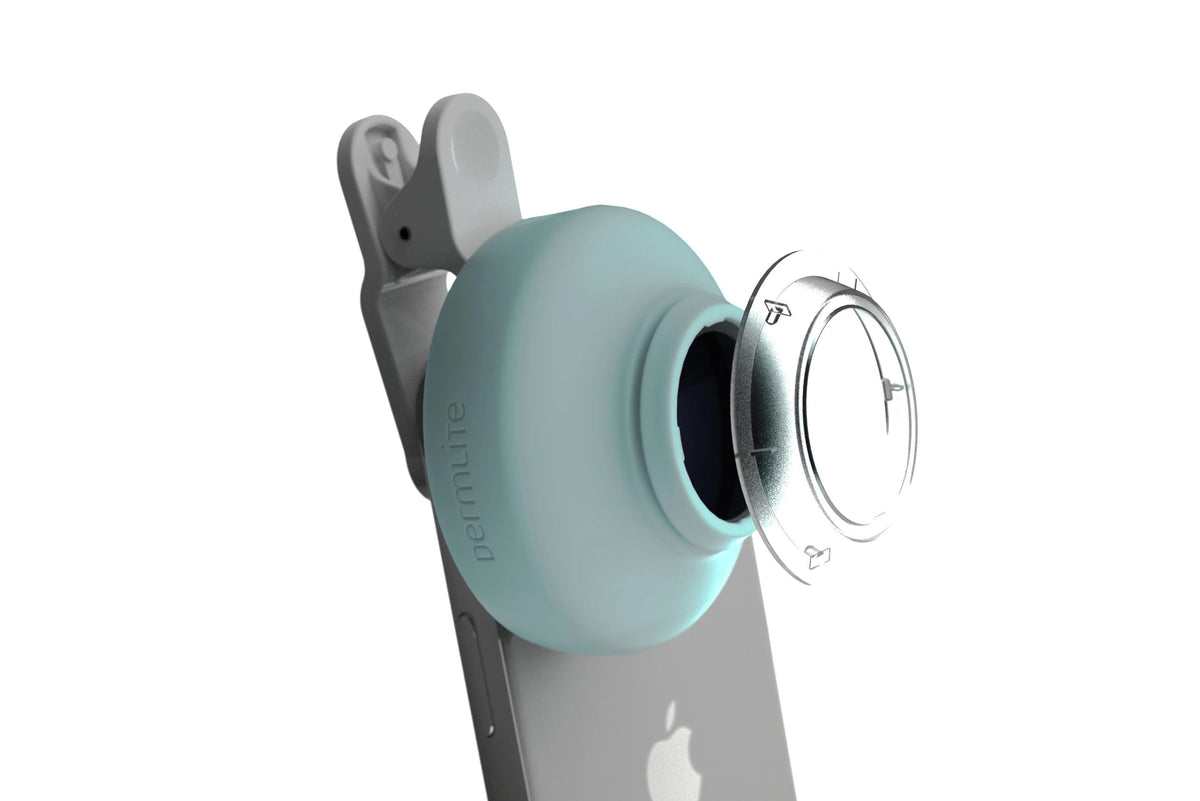 DermLite HÜD® 2 Home Dermatoscope